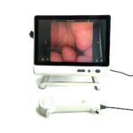 Ureteroscópio flexível descartável