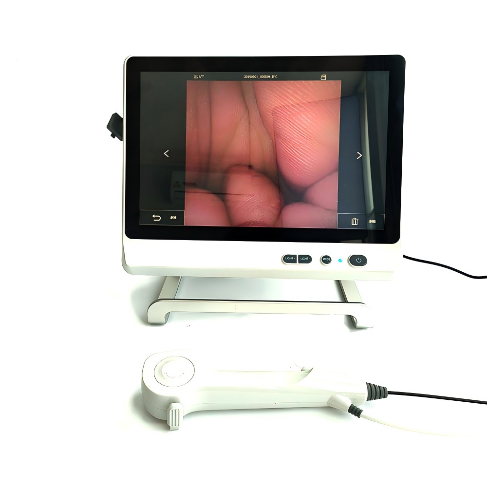 flex uro-1 Ureteroscópio flexível descartável - Imagem 1