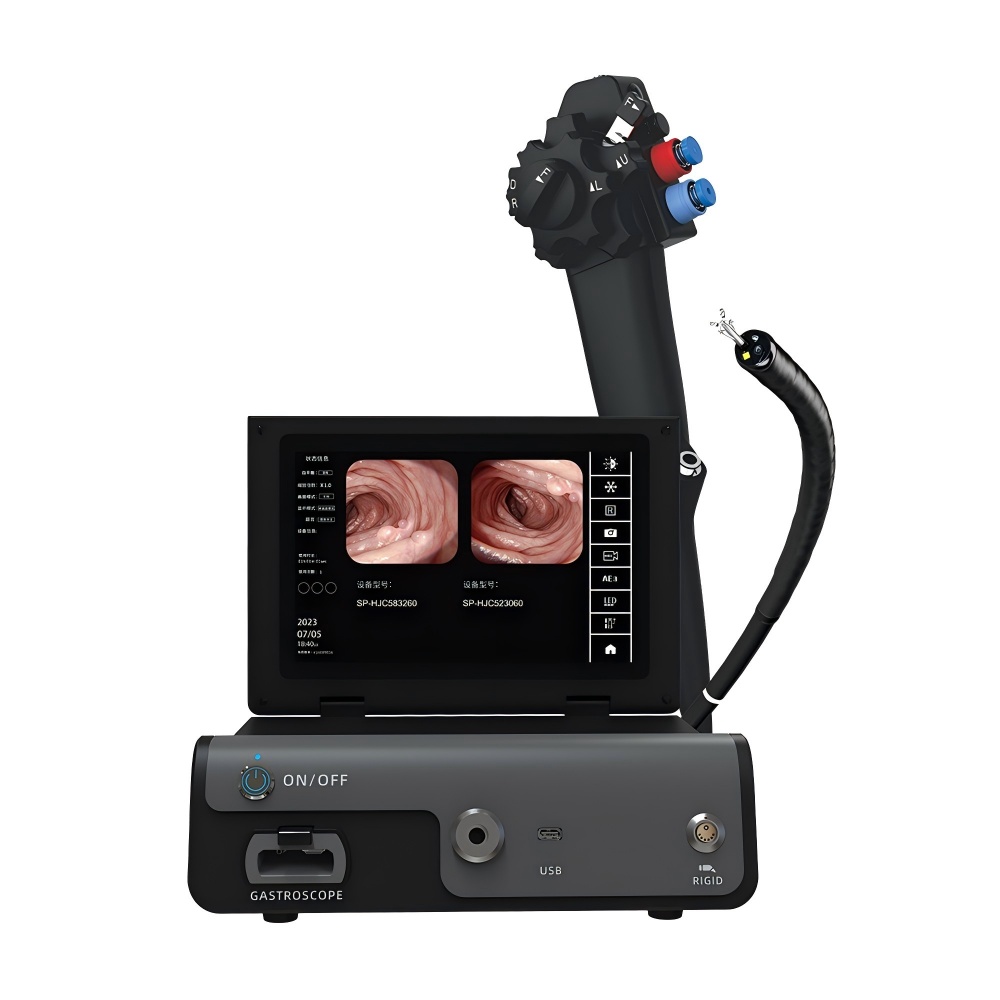 gastro-1 Gastroscópio digital com processador tudo em um - Imagem 1