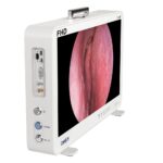 Sistema de Câmera Endoscópica Portátil 15.6 FHD Camjoy CF916 Unidade Tout-em-Um FHD FHD 03