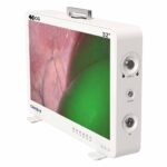 Sistema de Câmera de Endoscópio Camjoy CG932 4K-ICG FPGA de 32 polegadas 02